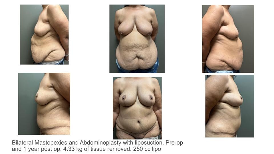 Before & After